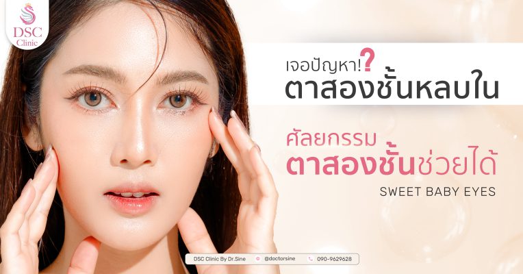 ปัญหาตาสองชั้นหลบในแก้ง่านนิดเดียว