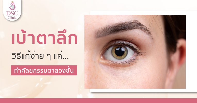 บ้าตาลึก วิธีแก้ที่ให้ผลลัพธ์ถาวรที่สุด