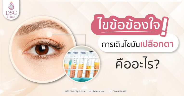 เติมไขมันเปลือกตา เสริมดวงตาดูมีชีวิตชีวามากยิ่งขึ้น