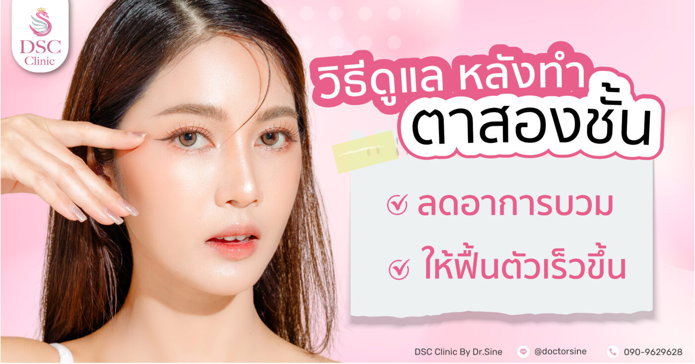 วิธีดูแลหลังทำตา 2 ชั้นให้เข้าที่เร็วและลดอาการบวมช้ำ