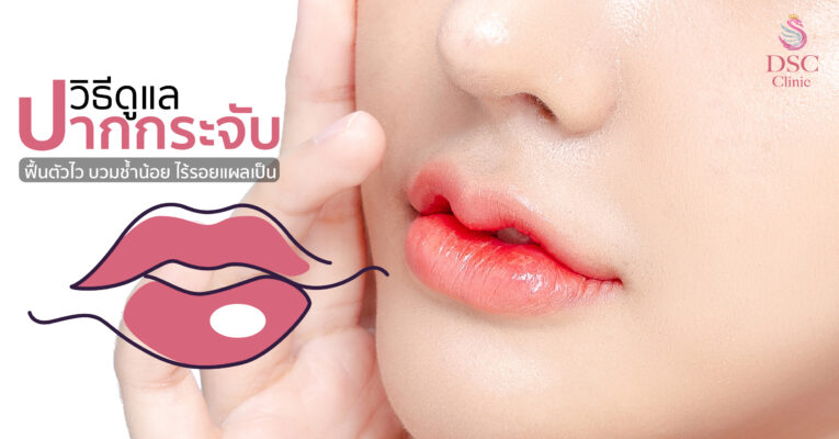 วิธีดูแลหลังทำปากกระจับ