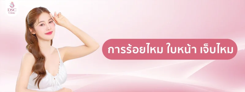 การร้อยไหม ใบหน้า เจ็บไหม copy