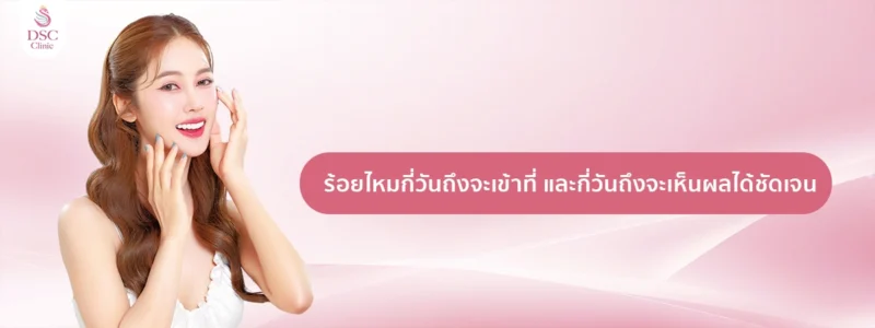 ร้อยไหม กี่วันถึงจะเข้าที่ และ กี่วันถึงจะเห็นผลได้ชัดเจน copy